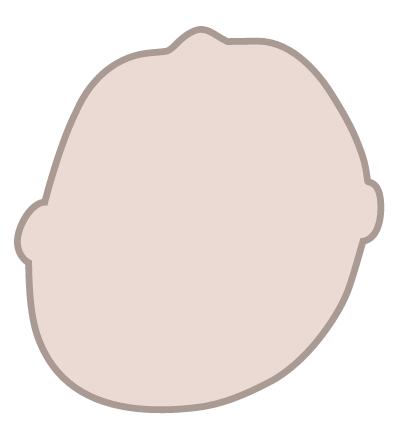 斜頭 図